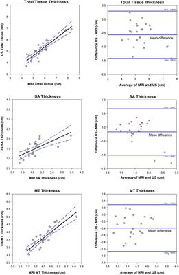 A novel approach for quantitative imaging of the seated anatomy of the buttocks using ultrasound and MRI